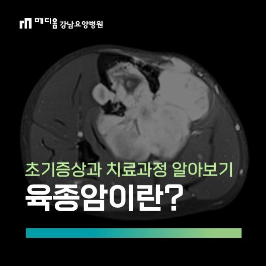 육종암이란? 초기증상과 종류, 진단과 치료 과정 알아보기