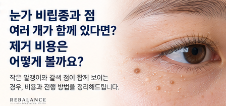 얼굴 편평사마귀·점이 수십 개 있다면? 여러 개 제거 비용과 무제한 기준