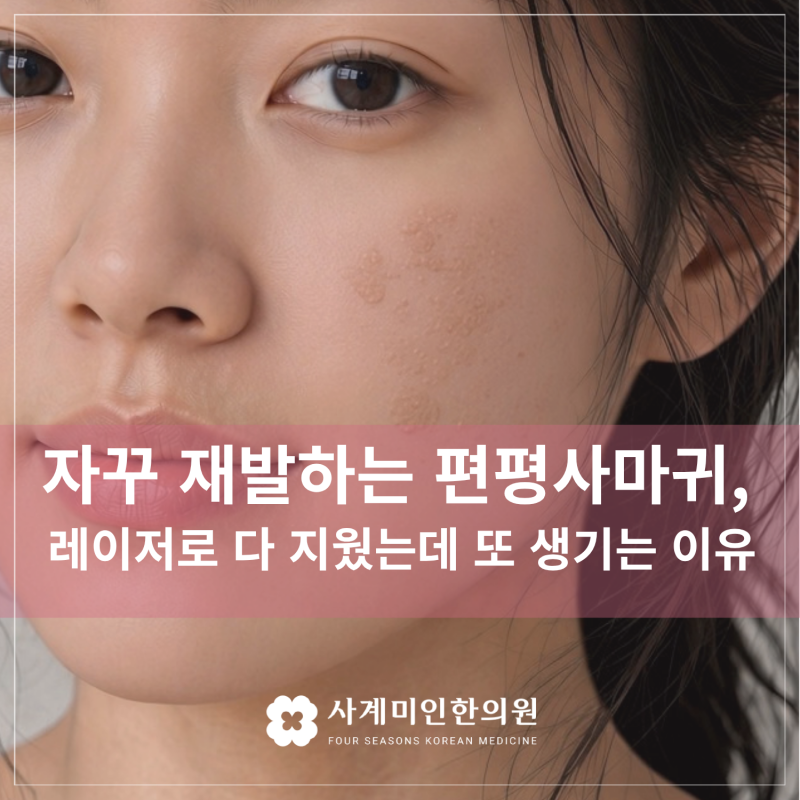 운중동한의원 | 편평사마귀, 레이저로 다 지웠는데 왜 또 생길까?