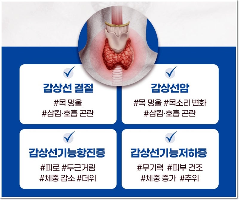 아급성 갑상선염 vs 하시모토 갑상선염, 통증 유무로 구별하는 방법