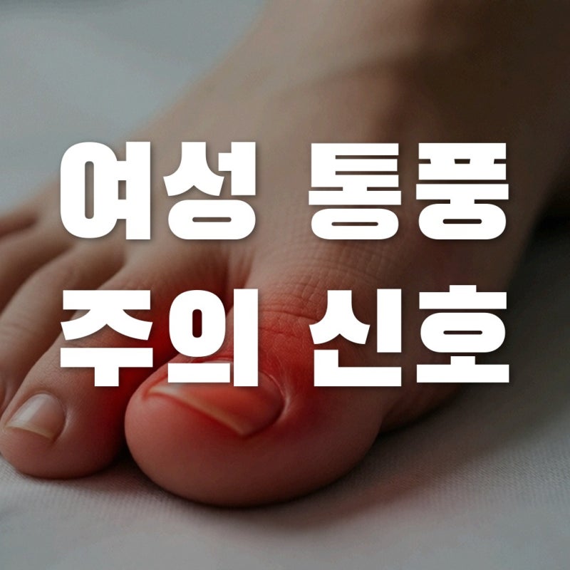 2026년 달라지는 여자 통풍 초기증상, 관절염과 다른 결정적 차이