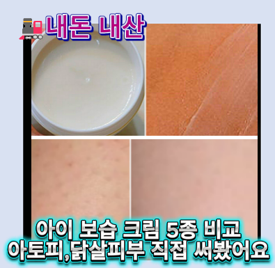 보습크림 아기로션 유아로션 비교｜아비노 나이트밤·아토오겔·아토팜·블랑카우 바디로션....