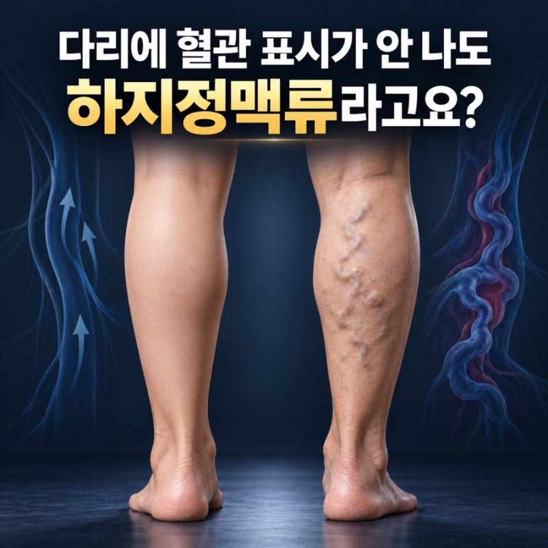 다리에 혈관 표시가 안 나도 하지정맥류라고요? 튀어나온 혈관만 찾고 있었다면 놓칠 수 있....