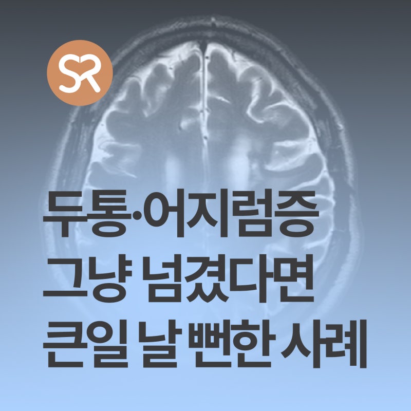두통·어지럼증·시야장애(눈 안보임, 시야결손) 그냥 넘겼다면 큰일 날 뻔했습니다｜뇌 MRI ....