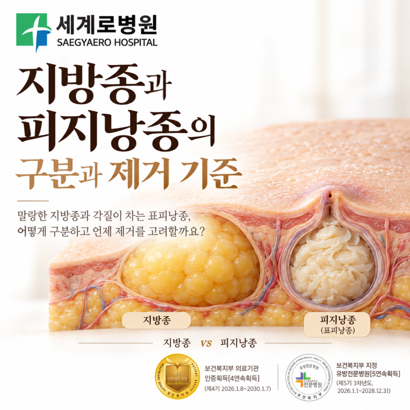 지방종과 피지낭종의 구분과 제거 기준