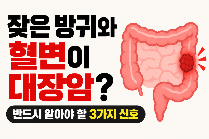 대장암 초기증상: 방귀, 혈변, 설사로 확인하는 자가 진단법