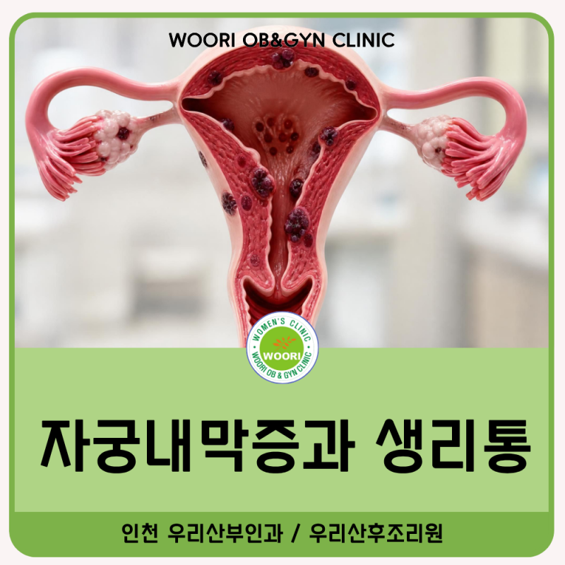 자궁내막증, 생리통이 심할수록 병원에 가야 할까요?