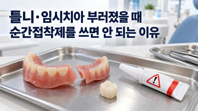 틀니·임시치아 파절, 순간접착제를 쓰면 안 되는 이유