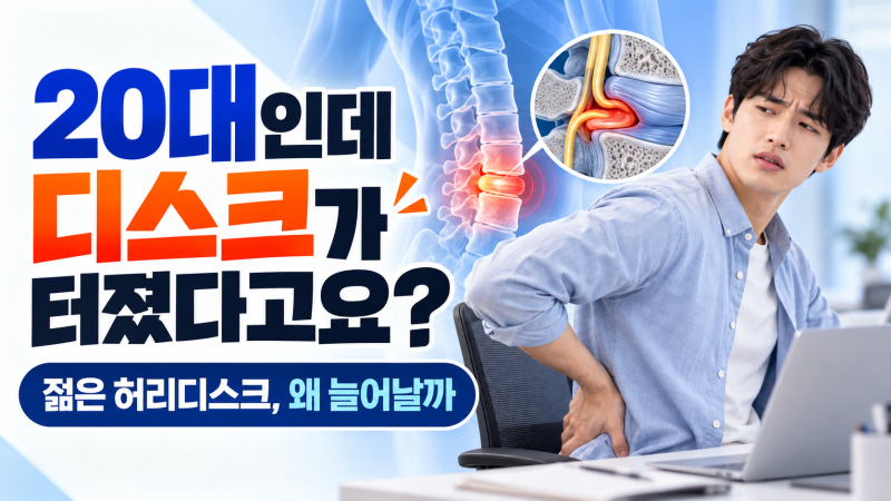 “20대인데 디스크가 터졌다고요?” 젊은 허리 디스크가 늘어나는 이유