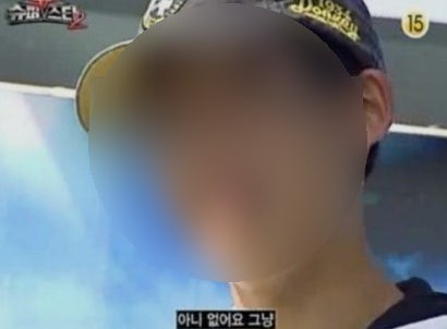 [내돈내산] 제주 겨드랑이 레이저 제모 2회차 후기(제주밴스의원, 1년권)