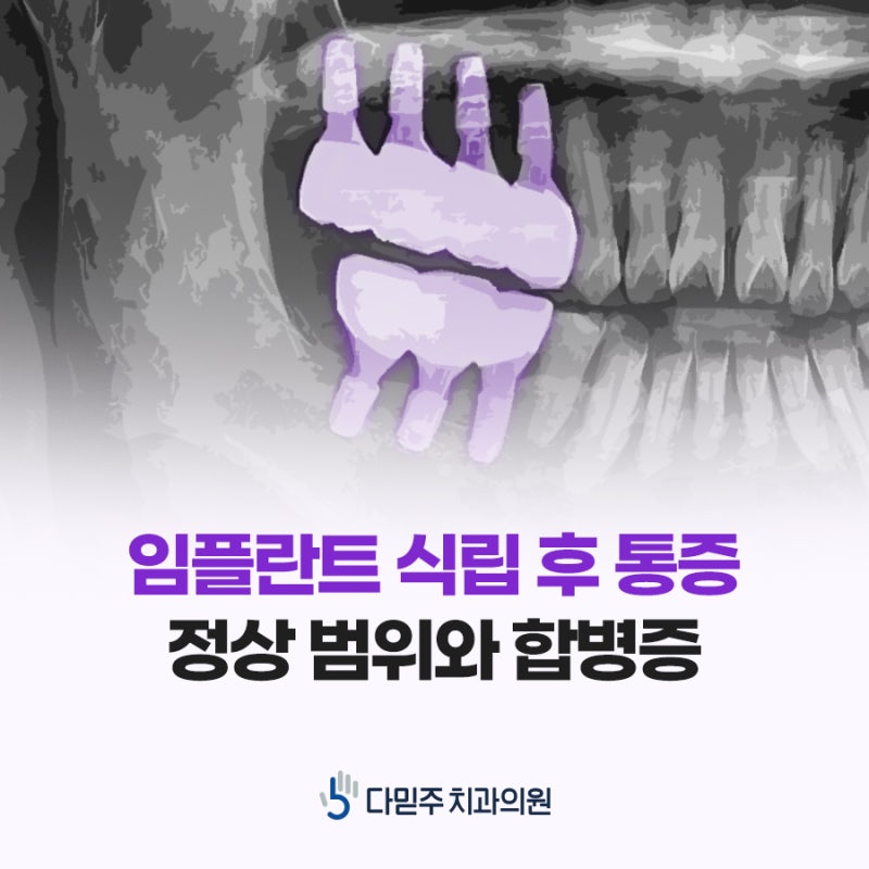 부산진구 치과 임플란트 식립 후 통증 언제까지 정상일까?