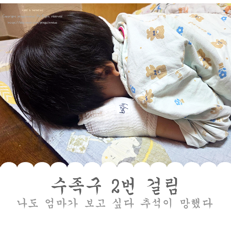 수족구 2번 걸림 이번 추석은 망했어 남매가 쌍으로 입원병원비 환장