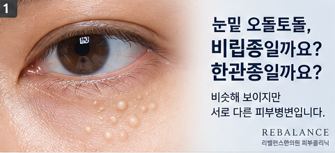 편평사마귀 제거 후 딱지는 언제 떨어질까요? 세안·화장까지 궁금한 점