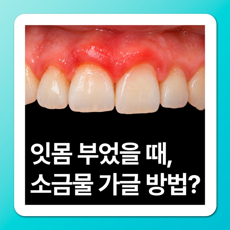 잇몸 부음 소금물 가글, 농도는 어떻게 맞출까요?