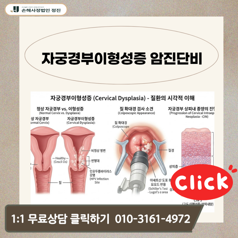 자궁경부이형성증 암진단비, N87.1 코드인데 D06 제자리암 보상 가능할까?