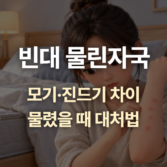빈대 물린자국 어떻게 구별할까? 모기·진드기 차이와 물렸을 때 대처법