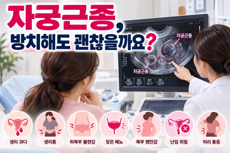 자궁근종 (양성종양), 방치해도 괜찮을까요?