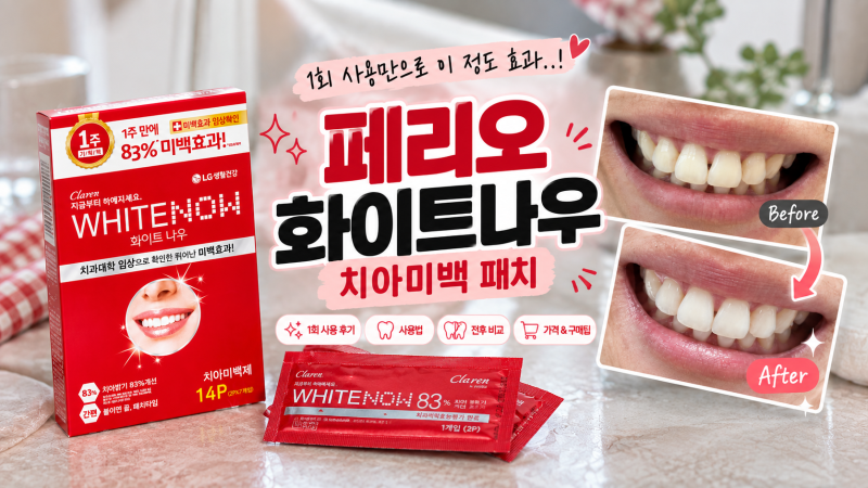 [치아미백템] 페리오 화이트나우 미백 패치 일주일팩 사용 후기