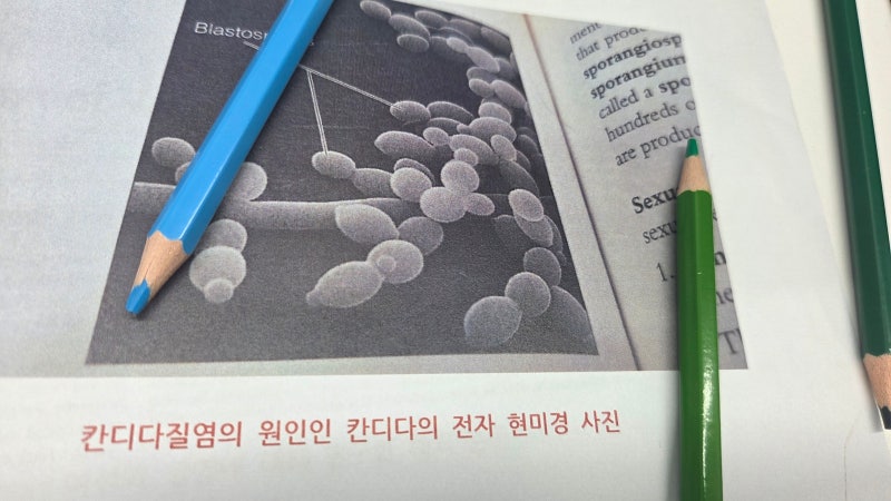 칸디다질염 원인 약 안쓰고 자연치유 증상 체크