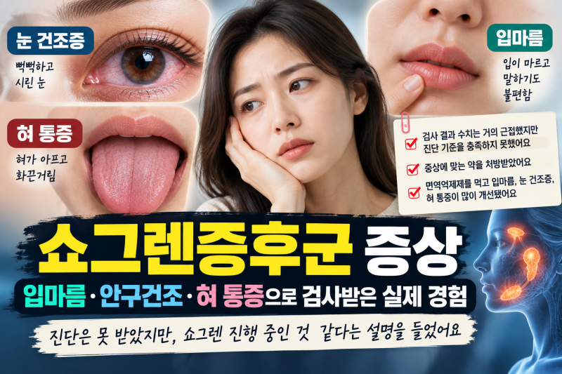 쇼그렌증후군 증상, 입마름·안구건조·혀 통증으로 검사받은 실제 경험｜진단 기준에는 못 ....