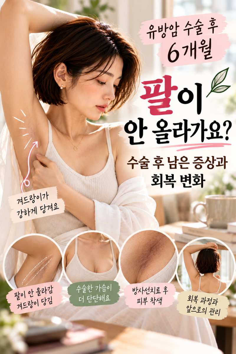 [ 유방암 수술 후 6개월 ] 팔이 안 올라가요? 수술 후 남은 증상과 회복 변화