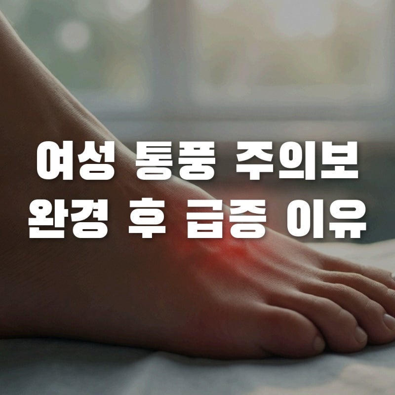 여자 통풍 초기증상, 완경 후 급증하는 이유와 관절염 차이점 정리