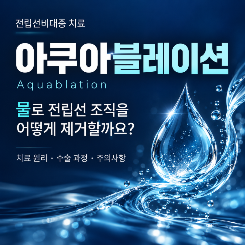 부산 서면 전립선비대증 아쿠아블레이션, 물로 조직을 어떻게 제거 할까?