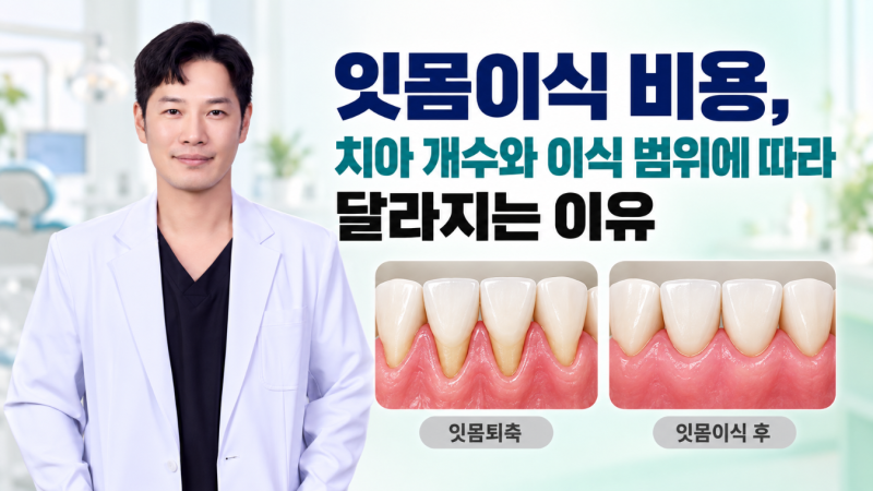 잇몸이식 비용, 교정 후 잇몸내려감과 잇몸퇴축 범위에 따라 달라지는 기준