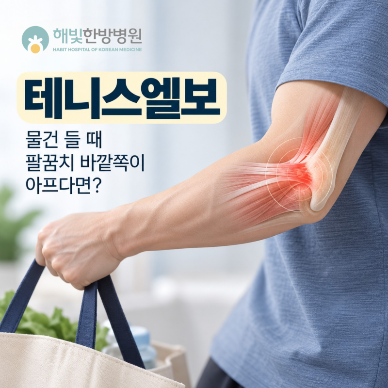 전주 테니스엘보, 물건 들 때 팔꿈치 바깥쪽이 아프다면?