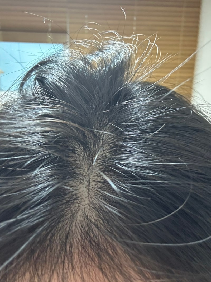 헤어토닉 사용법 염색 후 두피 열감과 건조함이 신경 쓰일 때 헤넬 헤어토닉