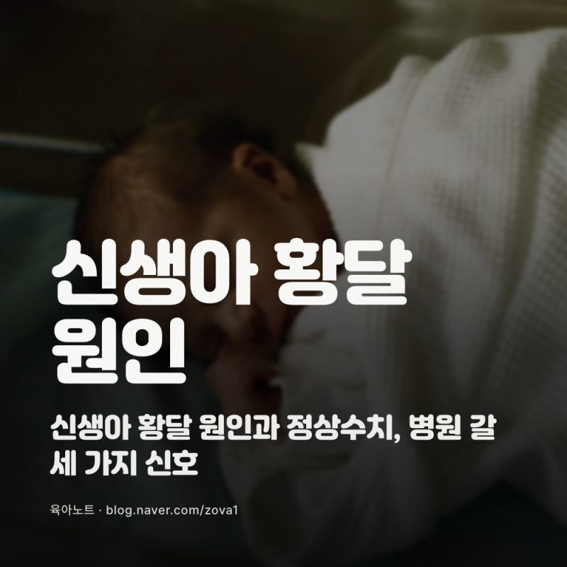 신생아 황달 원인과 정상수치, 병원 갈 세 가지 신호
