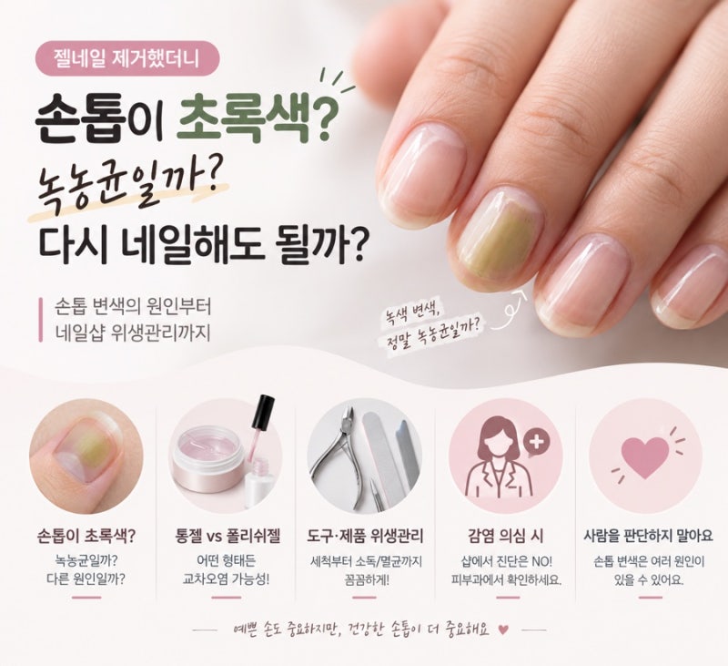 젤네일 제거했더니 손톱이 초록색? 녹농균일까? 다시 네일해도 될까
