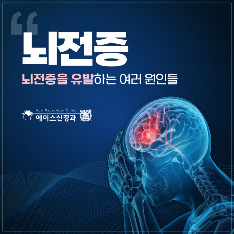 뇌전증 발생 기전 뇌전증 원인 뇌전증 유전 여부