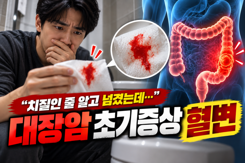 치질인 줄 알고 넘겼는데 대장암 초기증상 혈변, 이런 경우는 확인해야 합니다