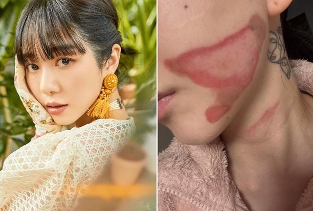 피부과가 "컴플레인 예약은 안 받습니다"라고 말한 이유, 권민아 녹취록의 충격