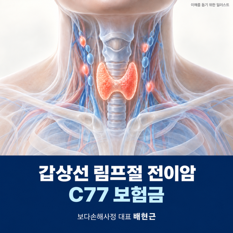갑상선 림프절 전이암 C77 보험금, 이미 받았어도 이 서류는 확인해 보세요