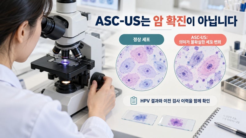 자궁경부암 아스쿠스 ASC-US, 암일까? HPV 양성·음성과 재검 기준