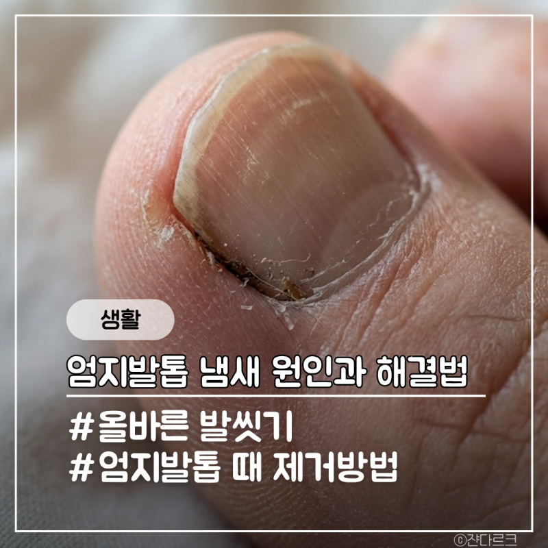 엄지발톱 냄새나는 이유와 해결방법