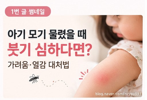 아기 모기 물렸을 때 붓기 심하다면? 가려움·열감 대처법