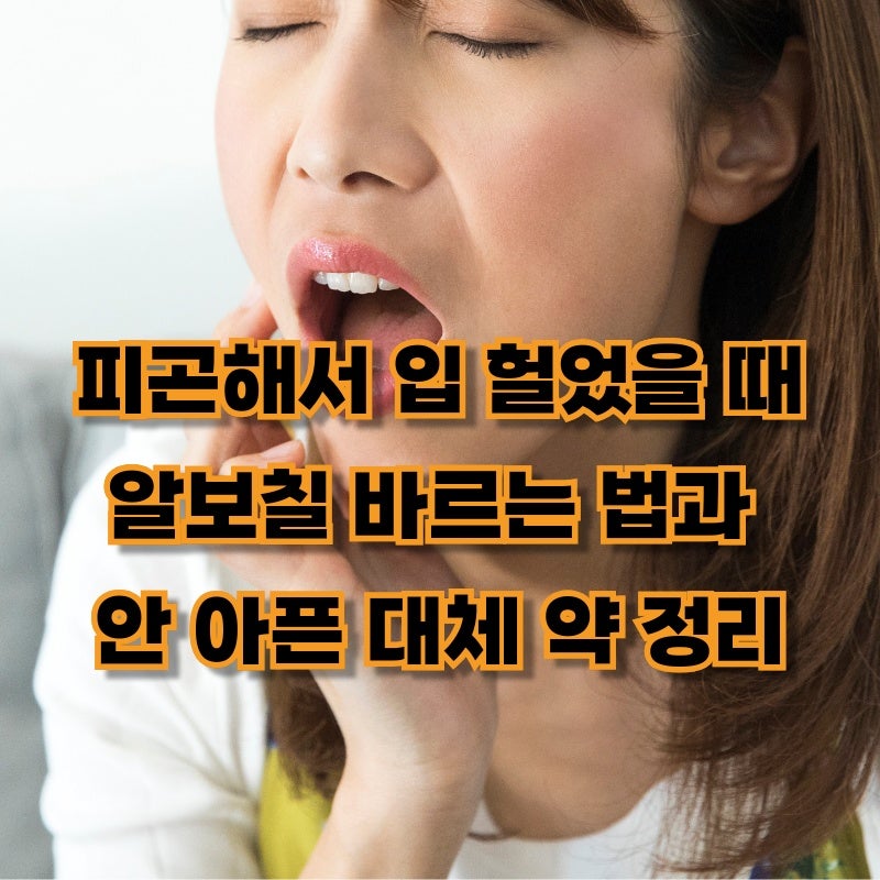 피곤해서 입 헐었을 때 알보칠 바르는 법과 안 아픈 대체 약 정리