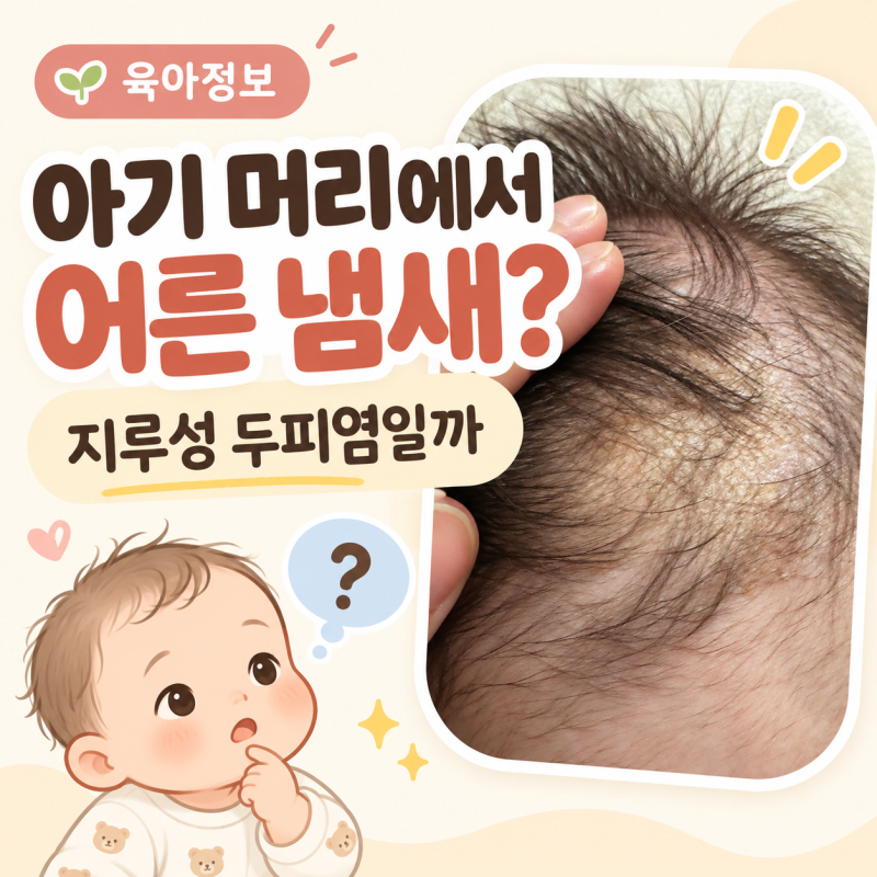 아기 머리에서 어른 두피 냄새가 난다면? 지루성 두피염 관리해본 후기