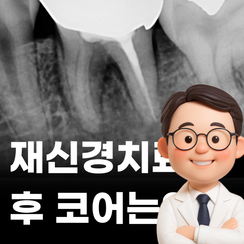 재신경치료 후 크라운을 꼭 해야하는 이유