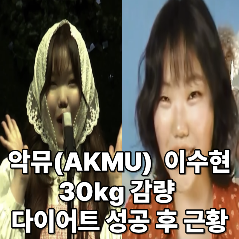 악뮤 이수현, 30kg 감량 후 근황 공개! 유지 성공?