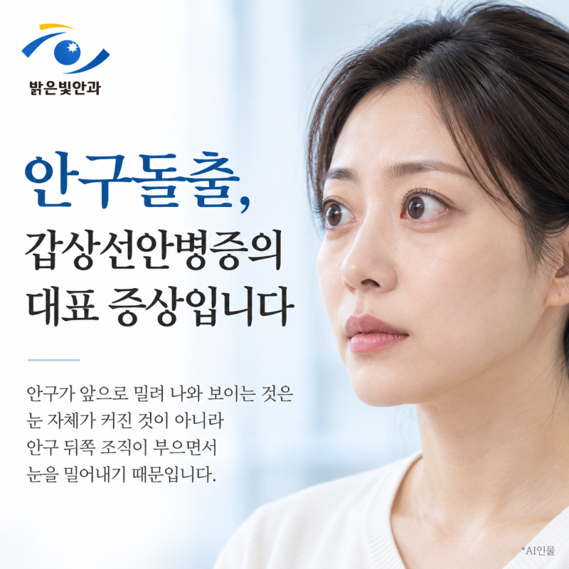 안구돌출, 갑상선안병증의 대표 증상입니다