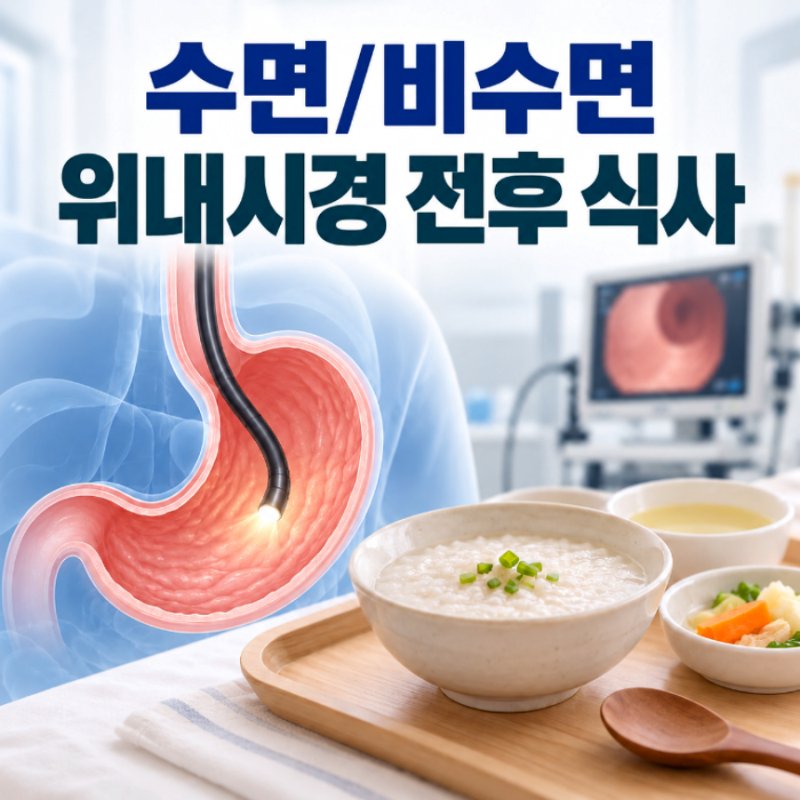 위 수면내시경 비용 비수면 위내시경 후 식사