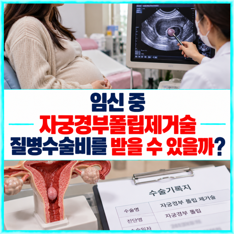 임신 중 자궁경부 폴립을 제거했다면 질병수술비를 받을 수 있을까요?
