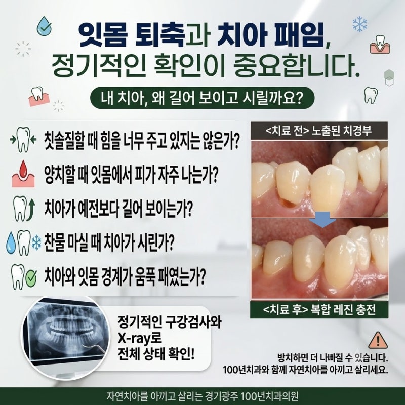 잇몸이 내려앉고 치아가 패였다면? 시린이의 원인과 치경부마모증