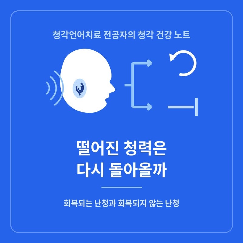 떨어진 청력은 다시 돌아올까: 회복되는 난청과 회복되지 않는 난청의 갈림길