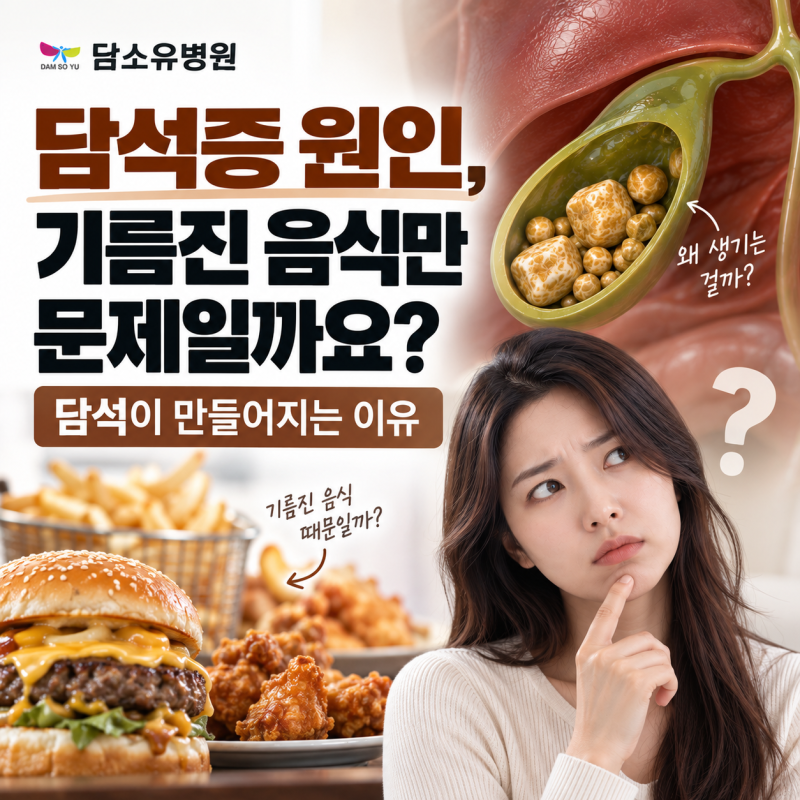 담석증 원인, 기름진 음식만 문제일까요? 담석이 만들어지는 이유