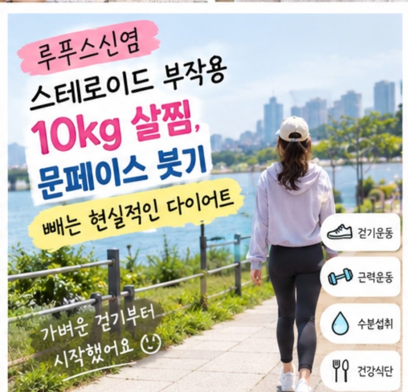 루푸스신염 스테로이드 부작용 10kg 살찜, 문페이스 붓기 빼는 현실적인 다이어트